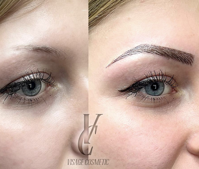 Microblading