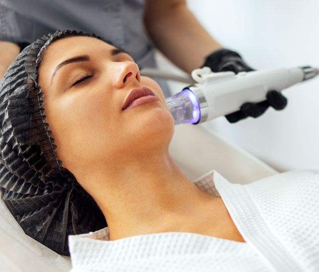 Microneedling Radiofrequenz