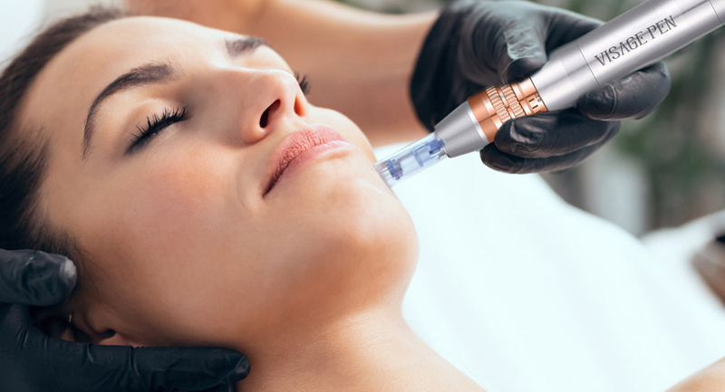 Microneedling